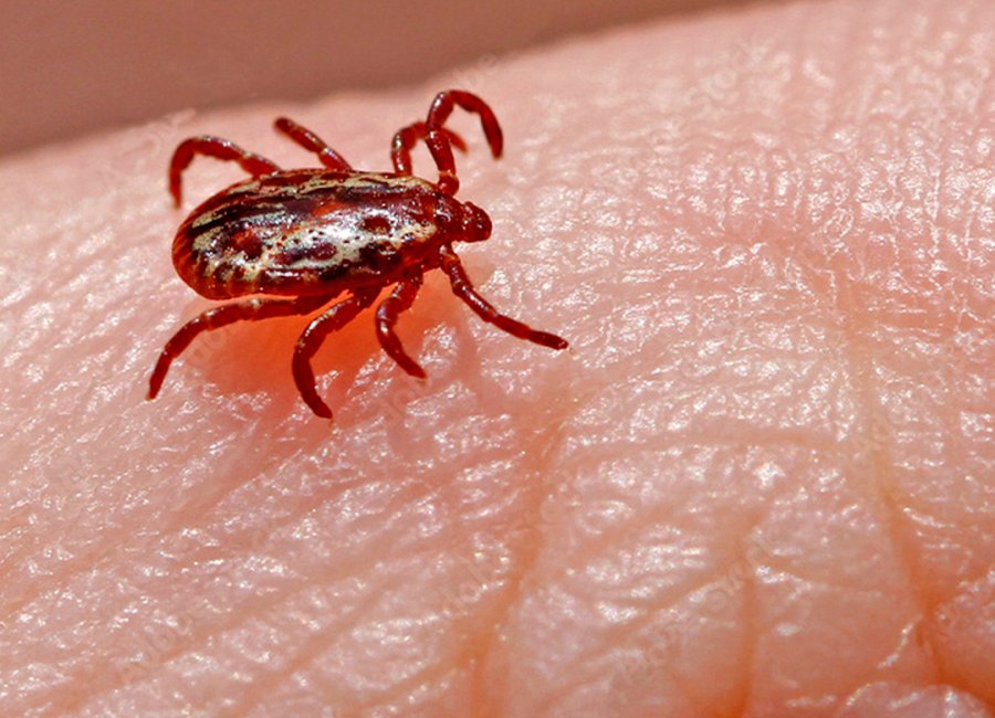 Mogi Guaçu registra primeiro óbito por Febre Maculosa de 2023