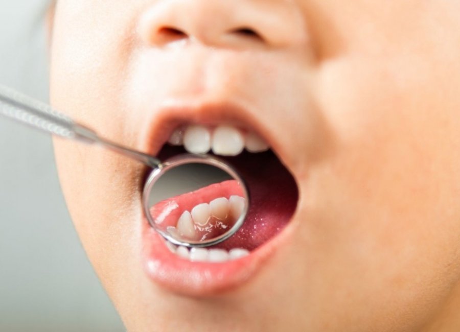 Ação de saúde bucal será realizada em escola rural